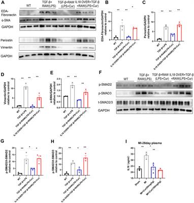 Curcumin Ameliorates Cardiac Fibrosis by Regulating Macrophage-Fibroblast Crosstalk via IL18-P-SMAD2/3 Signaling Pathway Inhibition